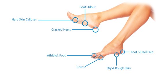 GetUSCart- Plantar Fasciitis Heel Cups for Heel Pain ?Updated Version? Heel  Protectors Heel Sleeves Pads, Heel Support for Heel Pain, Heel Spur, Cracked  Heels for Women and Men (Black, M 8.5-12 / W 10-13)